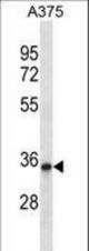 DYSFIP1 Antibody western blot of A375 cell line lysates (35 ug/lane). The DYSFIP1 antibody detected the DYSFIP1 protein (arrow).