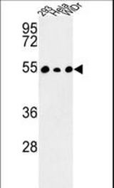 Western blot of C14orf50 Antibody in 293, HeLa, WiDr cell line lysates (35 ug/lane). C14orf50 (arrow) was detected using the purified antibody.