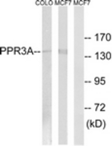Western blot of extracts from MCF-7/COLO cells, using PPP1R3A Antibody. The lane on the right is treated with the synthesized peptide.