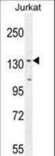 PPP1R3A Antibody western blot of Jurkat cell line lysates (35 ug/lane). The PPP1R3A antibody detected the PPP1R3A protein (arrow).
