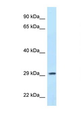 PPP1R3B antibody LS-C145520 Western blot of MCF7 Cell lysate. Antibody concentration 1 ug/ml.