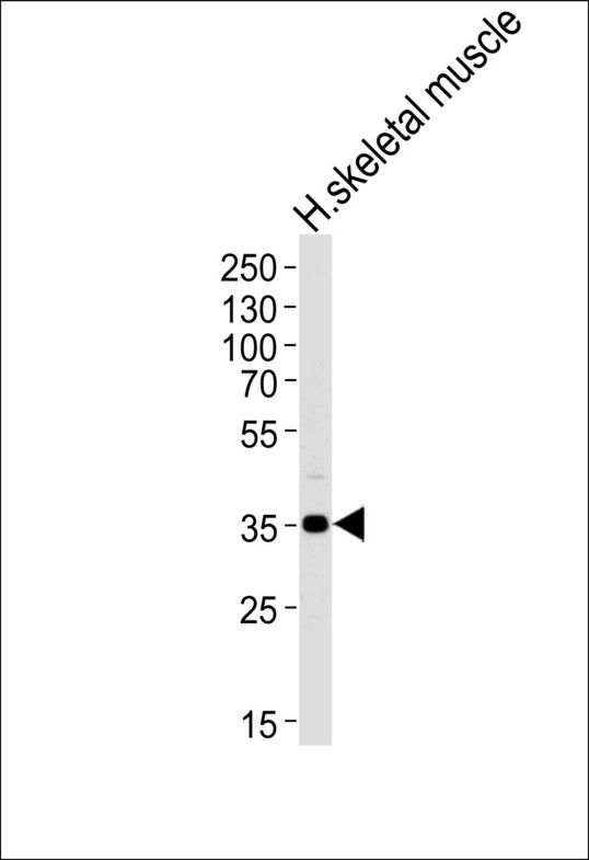 Western blot of lysate from human skeletal muscle tissue lysate, using PPP1R3B Antibody. Antibody was diluted at 1:1000 at each lane. A goat anti-rabbit IgG H&L (HRP) at 1:5000 dilution was used as the secondary antibody. Lysate at 35ug per lane.