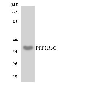 Western blot of the lysates from HeLa cells using PPP1R3C antibody.