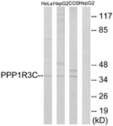 Western blot of extracts from HepG2/HeLa/COS7 cells, using PPP1R3C Antibody. The lane on the right is treated with the synthesized peptide.
