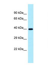 PPP1R3C antibody LS-C146013 Western blot of 293T Cell lysate. Antibody concentration 1 ug/ml.