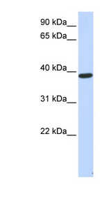 PPP1R7 antibody LS-C102701 Western blot of Fetal Muscle lysate.