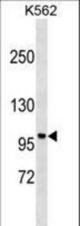 PPP1R9A Antibody western blot of K562 cell line lysates (35 ug/lane). The PPP1R9A antibody detected the PPP1R9A protein (arrow).