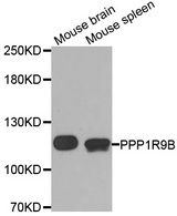 Western blot analysis of extracts of various cell lines, using PPP1R9B antibody.