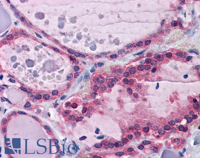 Anti-PPP2R1A antibody IHC of human thyroid. Immunohistochemistry of formalin-fixed, paraffin-embedded tissue after heat-induced antigen retrieval. Antibody LS-B4451 concentration 3.75 ug/ml.