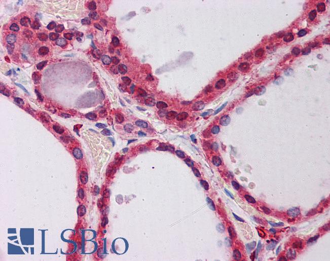 Anti-PPP2R1A antibody IHC of human thyroid. Immunohistochemistry of formalin-fixed, paraffin-embedded tissue after heat-induced antigen retrieval. Antibody LS-B5871 concentration 5 ug/ml.