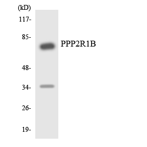 Western blot of the lysates from Jurkat cells using PPP2R1B antibody.