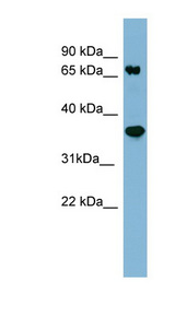 PPP2R1B antibody LS-C107608 Western blot of Fetal Thymus lysate.
