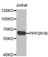 Western blot analysis of extracts of Jurkat cell line, using PPP2R1B antibody.