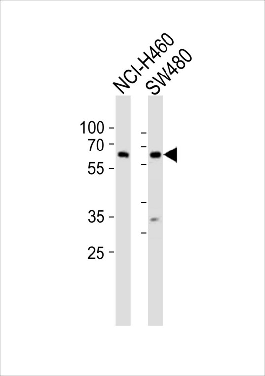 Western blot of lysates from NCI-H460, SW480 cell line (from left to right) with PPP2R1B Antibody. Antibody was diluted at 1:1000 at each lane. A goat anti-rabbit IgG H&L (HRP) at 1:10000 dilution was used as the secondary antibody. Lysates at 20 ug per lane.