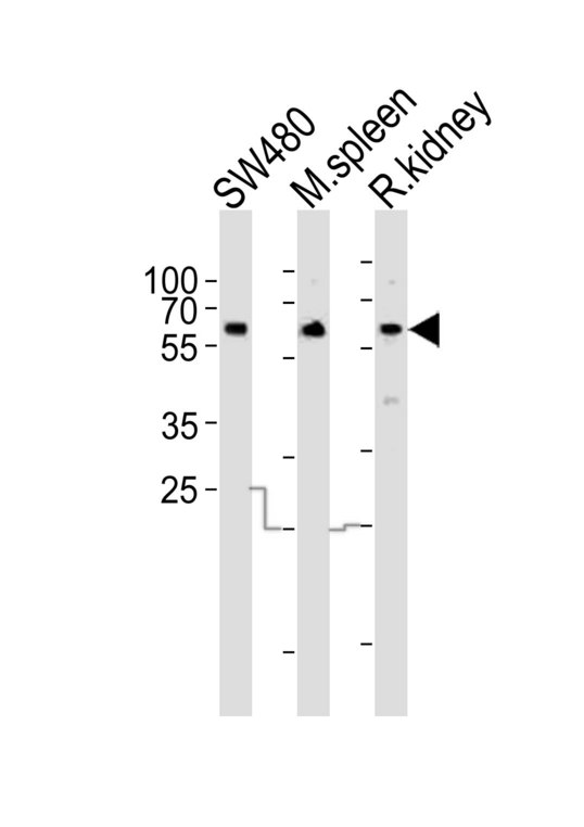 Western blot of lysates from SW480 cell line mouse spleen, rat kidney tissue (from left to right) with PPP2R1B Antibody. Antibody was diluted at 1:1000 at each lane. A goat anti-rabbit IgG H&L (HRP) at 1:10000 dilution was used as the secondary antibody. Lysates at 20 ug per lane.