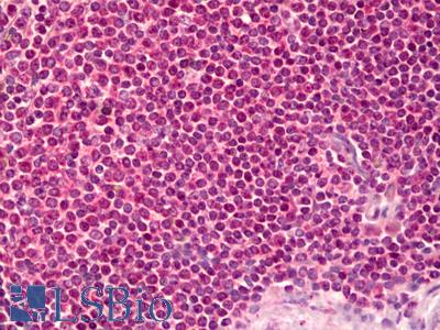 Anti-PPP2R1B antibody IHC of human spleen. Immunohistochemistry of formalin-fixed, paraffin-embedded tissue after heat-induced antigen retrieval. Antibody LS-B6593 concentration 5 ug/ml.