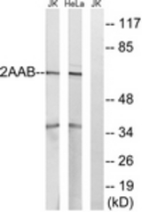 Western blot of extracts from HeLa/Jurkat cells, using PPP2R1B Antibody. The lane on the right is treated with the synthesized peptide.