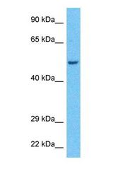 Western blot of 2ABA Antibody with human HeLa Whole Cell lysate.