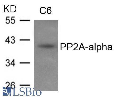Western blot of extracts from C6 cells using PP2A-alpha antibody.