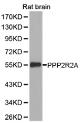 Western blot of extracts of rat brain cell lines, using PPP2R2A antibody.