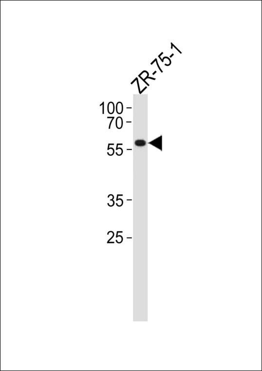 PPP2R2A Antibody western blot of ZR-75-1 cell line lysates (35 ug/lane). The PPP2R2A antibody detected the PPP2R2A protein (arrow).
