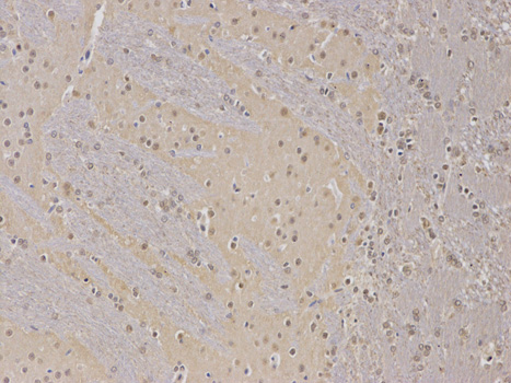 Immunohistochemistry of paraffin-embedded rat spleen using PPP2R2A antibody at dilution of 1:100 (200x lens).