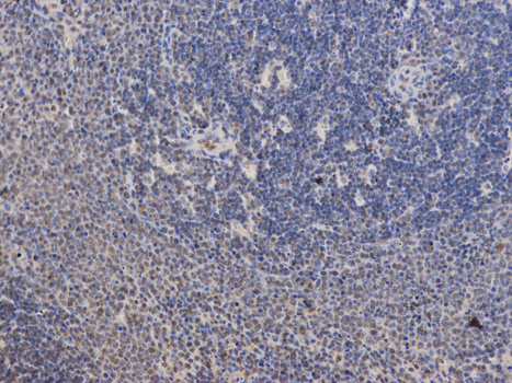 Immunohistochemistry of paraffin-embedded rat brain using PPP2R2A antibody at dilution of 1:100 (200x lens).