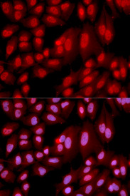 Immunofluorescence analysis of U2OS cell using PPP2R2A antibody. Blue: DAPI for nuclear staining.