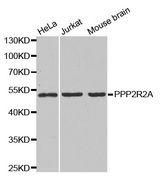 Western blot analysis of extracts of various cell lines, using PPP2R2A antibody.
