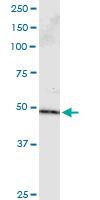 Immunoprecipitation of PPP2R2B transfected lysate using anti-PPP2R2B monoclonal antibody and Protein A Magnetic Bead.