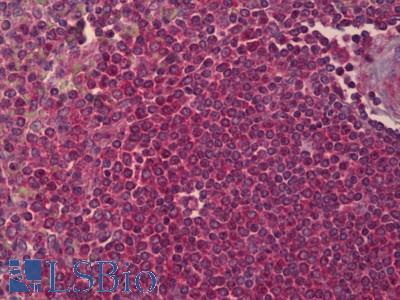 Anti-PPP2R2B antibody IHC of human spleen. Immunohistochemistry of formalin-fixed, paraffin-embedded tissue after heat-induced antigen retrieval. Antibody LS-B6417 concentration 5 ug/ml.