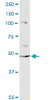 Immunoprecipitation of PPP2R2B transfected lysate using anti-PPP2R2B monoclonal antibody and Protein A magnetic bead, immunoblotted with PPP2R2B rabbit polyclonal antibody.