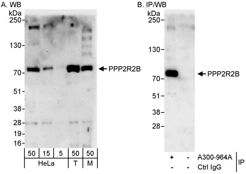Detection of Human and Mouse PPP2R2B by WB (h&m) and Immunoprecipitation (h). Samples: Whole cell lysate from HeLa (5, 15 and 50 ug for WB; 1 mg for IP, 20% of IP loaded), 293T (T; 50 ug) and mouse NIH3T3 (M; 50 ug) cells. Antibodies: Affinity purified rabbit anti-PPP2R2B antibody used for WB at 0.1 ug/ml (A) and 1 ug/ml (B) and used for IP at 3 ug/mg lysate (B). Detection: Chemiluminescence with exposure times of 3 minutes (A) and 30 seconds (B).