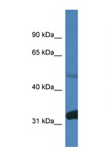 PPP2R2D antibody LS-C135373 Western blot of Mouse Brain lysate. Antibody concentration 1 ug/ml.