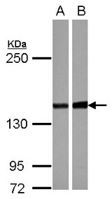 Sample (30 ug of whole cell lysate) A: NT2D1 B: U87-MG 5% SDS PAGE PPP2R3A antibody diluted at 1:1000