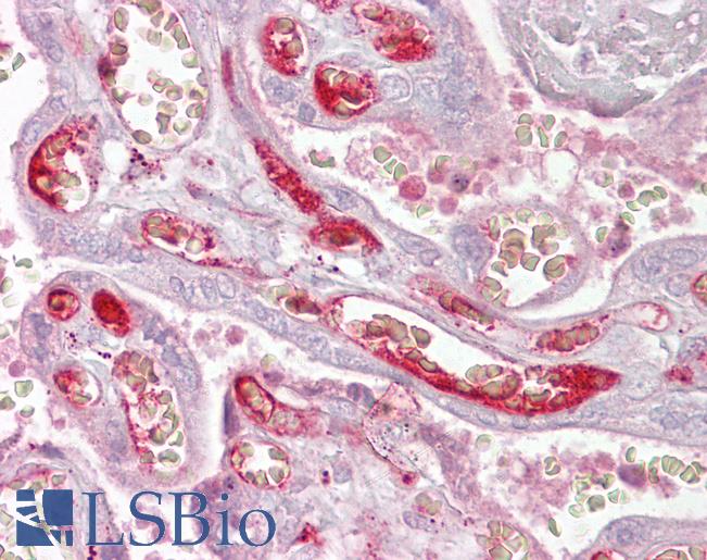 Anti-PPP2R3A antibody IHC of human placenta. Immunohistochemistry of formalin-fixed, paraffin-embedded tissue after heat-induced antigen retrieval. Antibody LS-B6915 concentration 5 ug/ml.