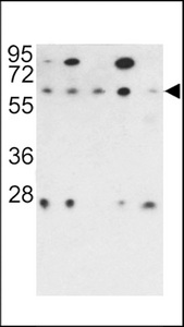Western blot of PR48 antibody in 293, NCI-H460, HeLa, K562 and HL60 cell line lysates (35 ug/lane). PR48 (arrow) was detected using the purified antibody.