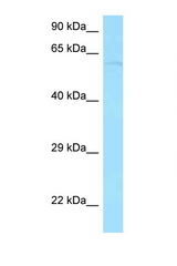 PPP2R3B antibody LS-C146511 Western blot of HeLa Cell lysate. Antibody concentration 1 ug/ml.