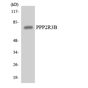 Western blot of the lysates from HT-29 cells using PPP2R3B antibody.