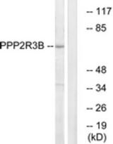 Western blot of extracts from K562 cells, using PPP2R3B Antibody. The lane on the right is treated with the synthesized peptide.