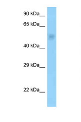 PPP2R3C antibody LS-C146287 Western blot of Rat Brain lysate. Antibody concentration 1 ug/ml.