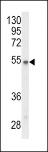 Western blot of P2R3C Antibody in Y79 cell line lysates (35 ug/lane). P2R3C (arrow) was detected using the purified antibody.