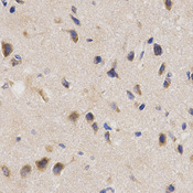 Immunohistochemistry of paraffin-embedded rat brain using PPP2R4 antibody at dilution of 1:200 (x400 lens).