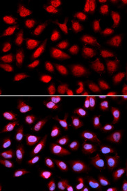 Immunofluorescence analysis of U2OS cell using PPP2R4 antibody. Blue: DAPI for nuclear staining.