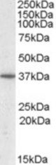 Antibody (0.5 ug/ml) staining of Human Liver lysate (35 ug protein in RIPA buffer). Primary incubation was 1 hour. Detected by chemiluminescence.