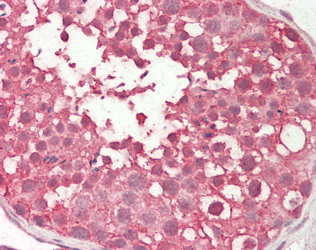 Human Testis: Formalin-Fixed, Paraffin-Embedded (FFPE)