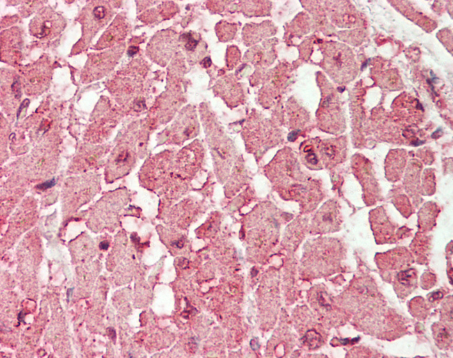 Human Heart: Formalin-Fixed, Paraffin-Embedded (FFPE)