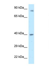 PPP2R4 antibody LS-C145719 Western blot of 721_B Cell lysate. Antibody concentration 1 ug/ml.