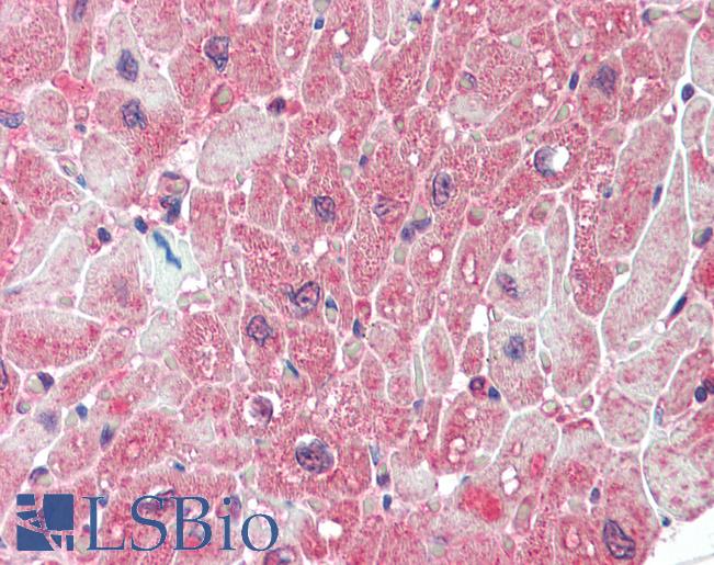 Anti-PPP2R5A antibody IHC staining of human heart. Immunohistochemistry of formalin-fixed, paraffin-embedded tissue after heat-induced antigen retrieval.