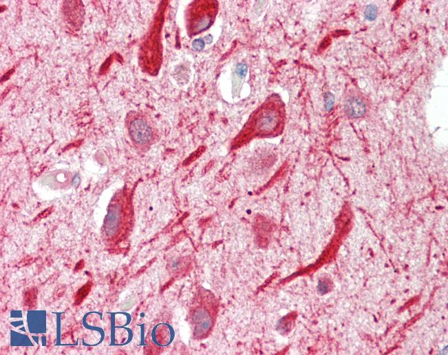 Anti-PPP2R5A antibody IHC staining of human brain, cortex. Immunohistochemistry of formalin-fixed, paraffin-embedded tissue after heat-induced antigen retrieval. Antibody LS-B10270 concentration 5 ug/ml.